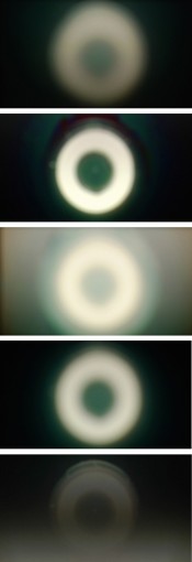 Eye